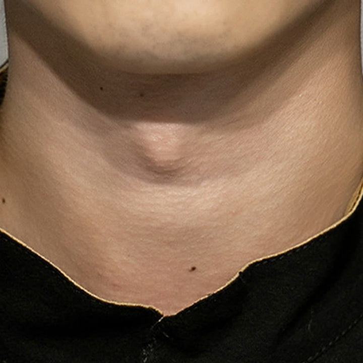 Buddha Stones Frog-Button Chinese Dragon Auspicious Cloud Embroidery Half Sleeve Shirt Cotton Linen Men Clothing - image 9